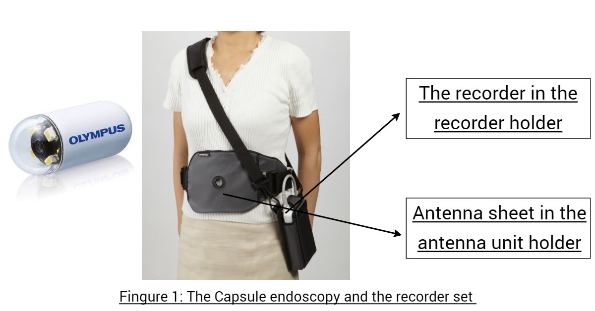 sgc-endoscopy